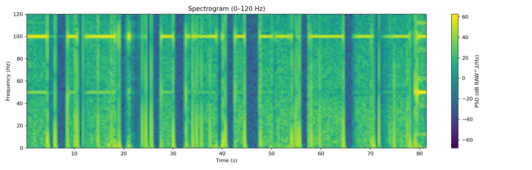 04_spectrogram