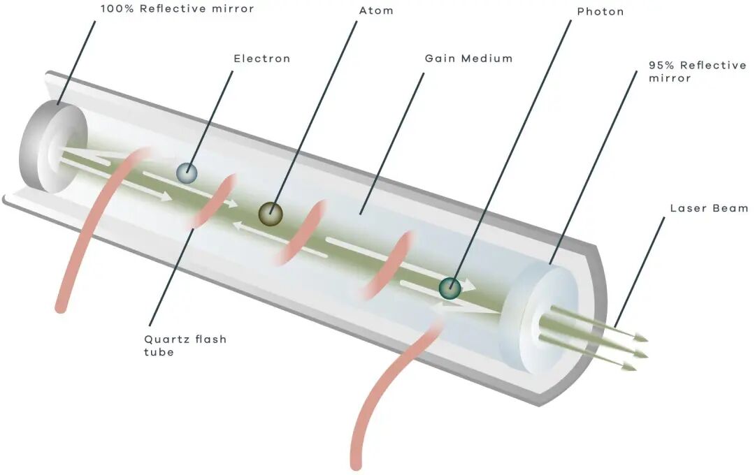 Nd:YAG Laser Treatment with the Experts at Anue